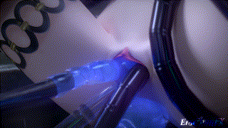 1-103f465ddd2f100ad.webp